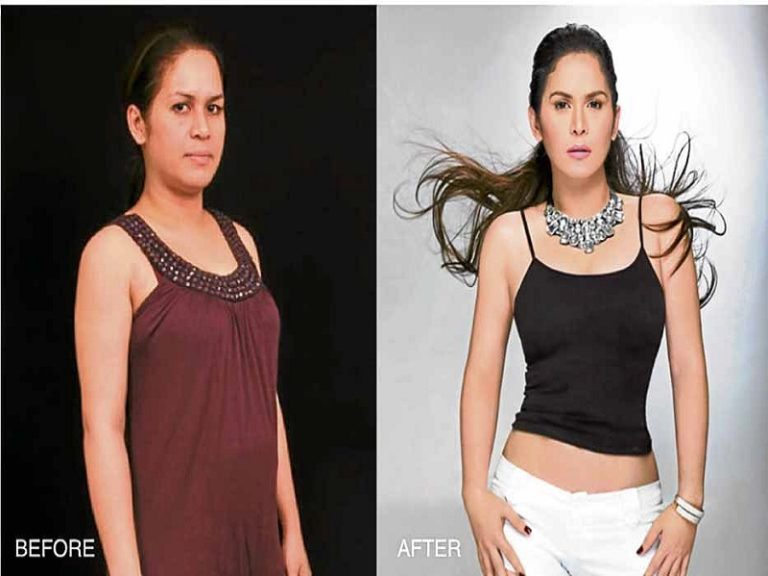 Jinkee Before and After DZIQ Radyo Inquirer 990AM DZIQ Radyo